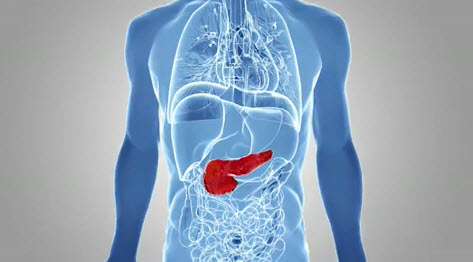 Pancreatic Cancer Treatment Options in Atlanta | Piedmont Healthcare