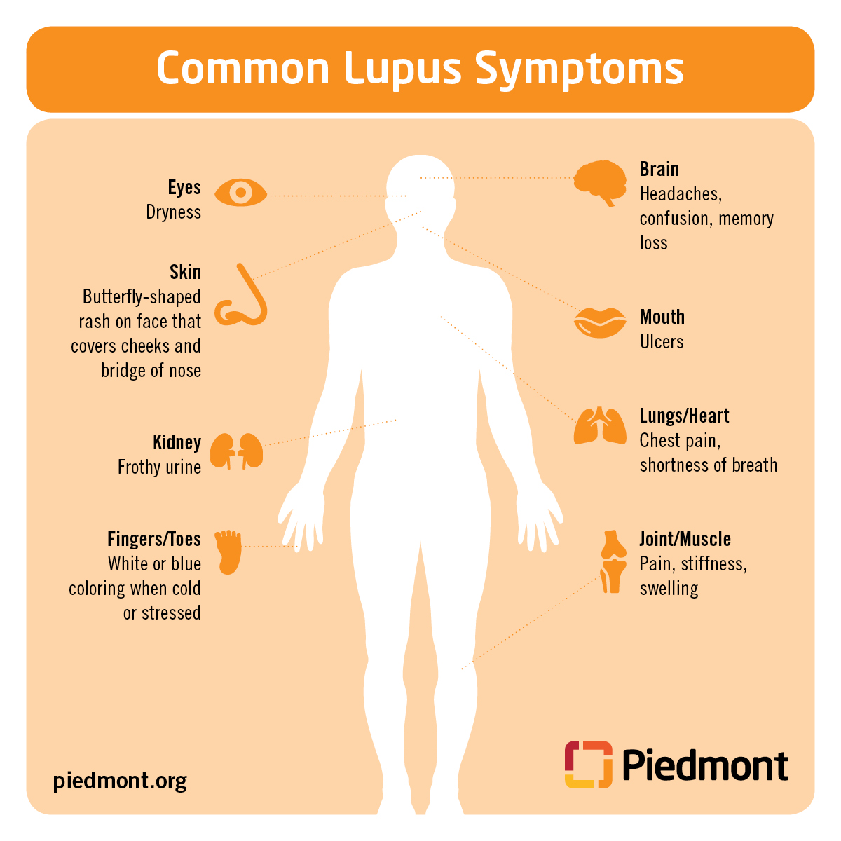 Lupus Causes, Symptoms and Treatment Information | Piedmont Healthcare
